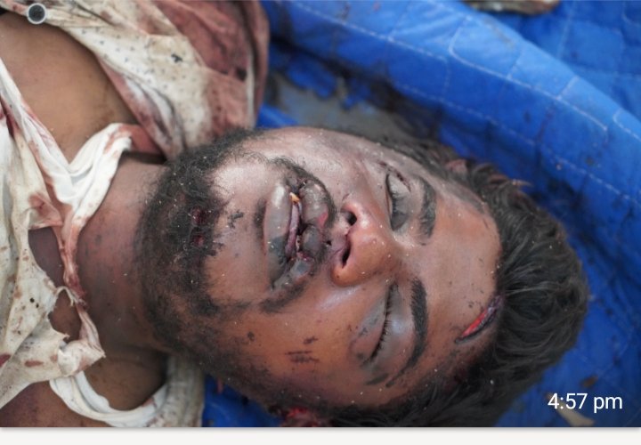 చేవెళ్ల మండలంలో కందవాడలో మర్డర్.. గుర్తు తెలియని వ్యక్తిని..  కొందరు వ్యక్తులు  చంపేసి వెళ్లారు.